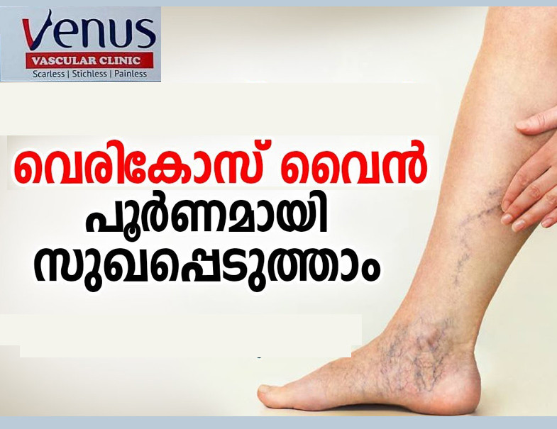 VENUS VASCULAR CLINIC ( TALAP )