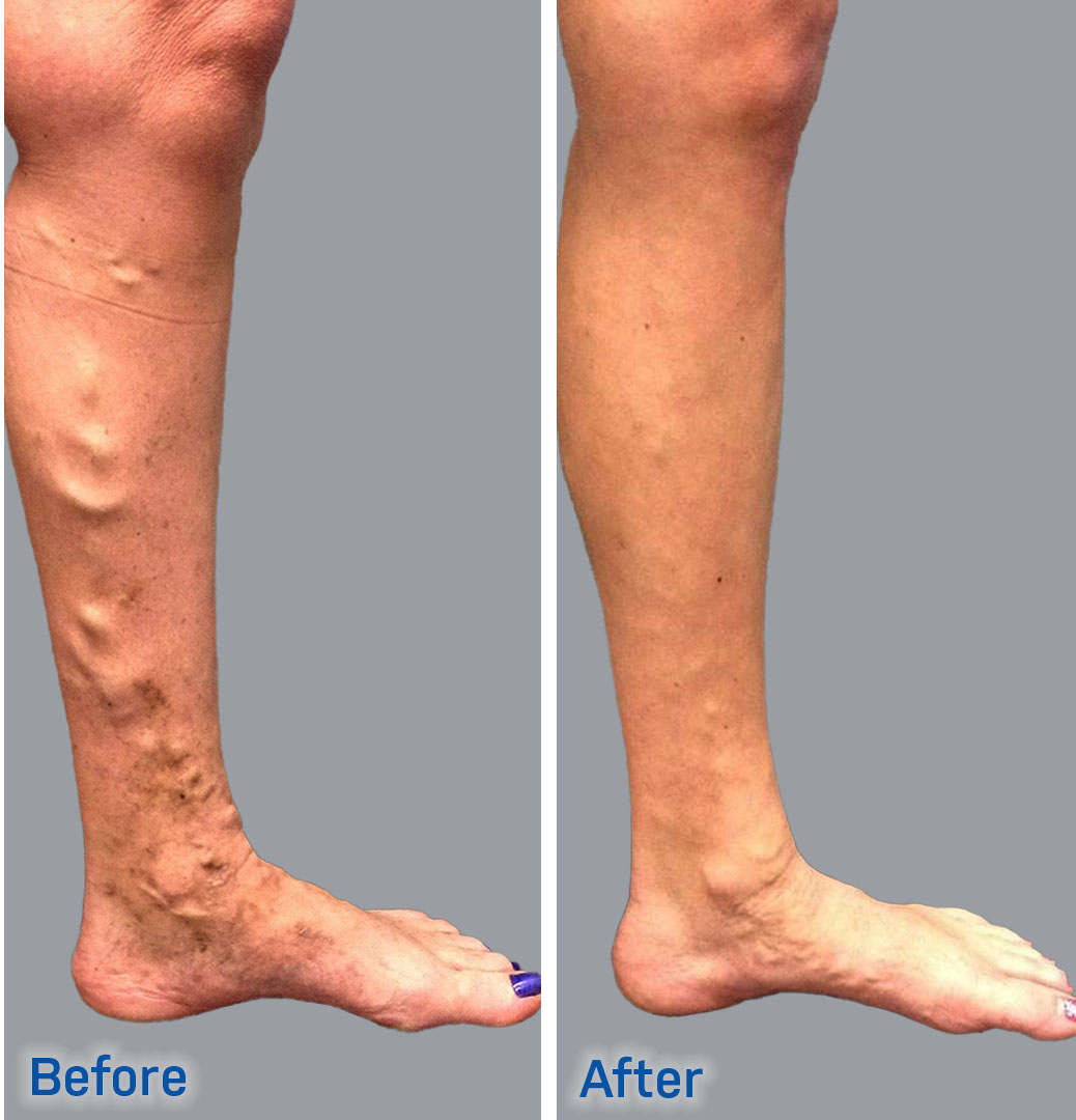 VENUS VASCULAR CLINIC ( TALAP )