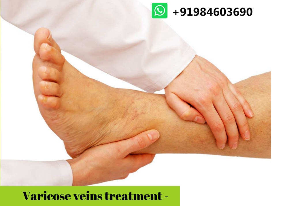 VENUS VASCULAR CLINIC ( TALAP )