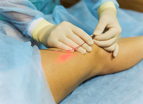 VENUS VASCULAR CLINIC ( TALAP )