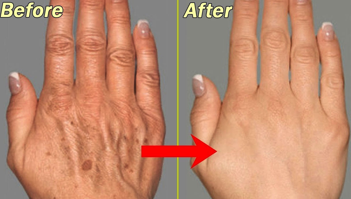VENUS VASCULAR CLINIC ( TALAP )