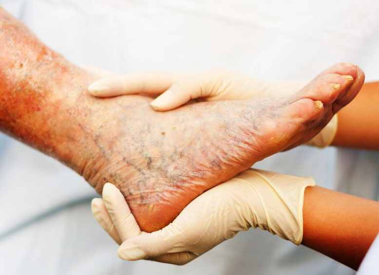 VENUS VASCULAR CLINIC ( TALAP )
