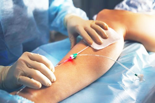VENUS VASCULAR CLINIC ( TALAP )